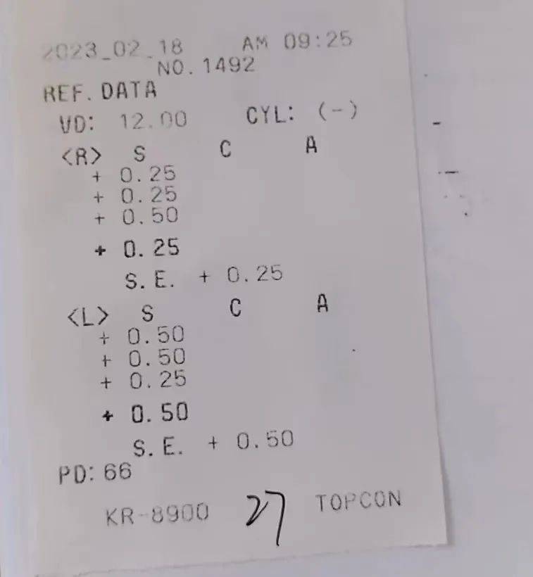 佳矫正视力，右眼1.0－，左眼1.0，术后2周复查，远视力右眼1.2-，左眼1.2。游主任表示：其实