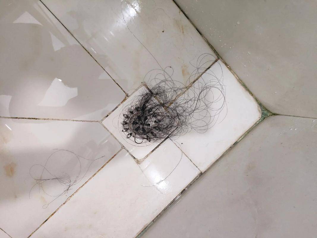 掉头发是什么原因引起的,怎样调理男生