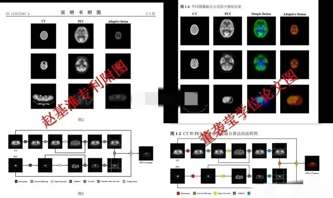 董袭莹实习期视频曝光，逻辑混乱语无伦次，再看王辰发言细思极恐