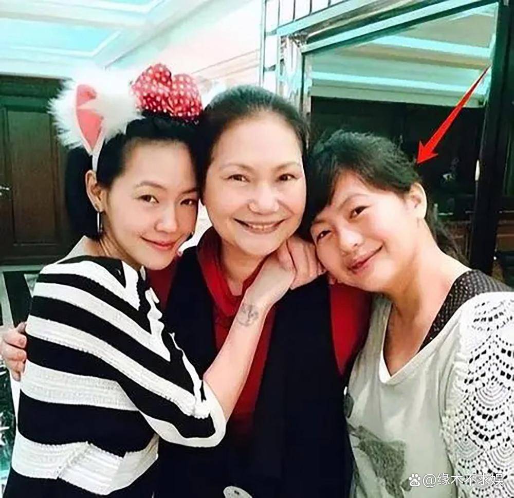 小S婆婆澳门旅游，眼含泪光心情悲痛，眼角淤青疑似受伤！