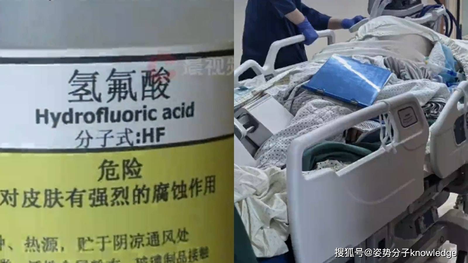 原创             俗称化骨水！致52岁女子身亡的氢氟酸有多恐怖？宛如“地雷”谁能防得住？