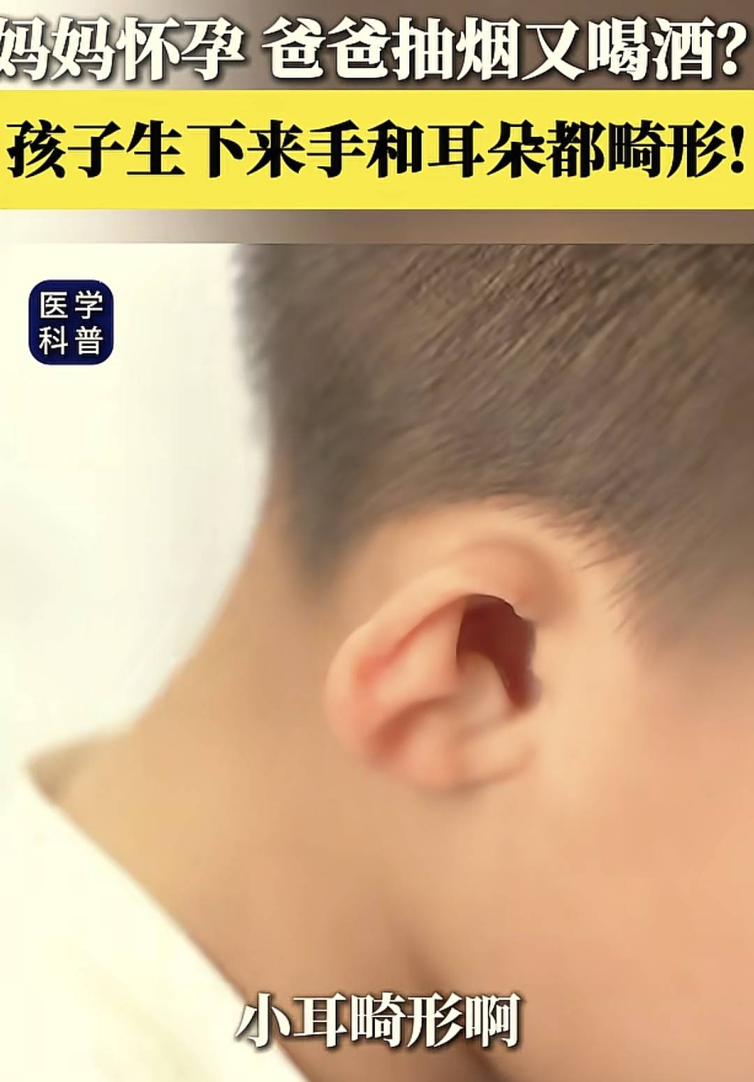 男人抽烟对家庭伤害多大?老婆流产,女儿肺癌,儿子身高少10厘米