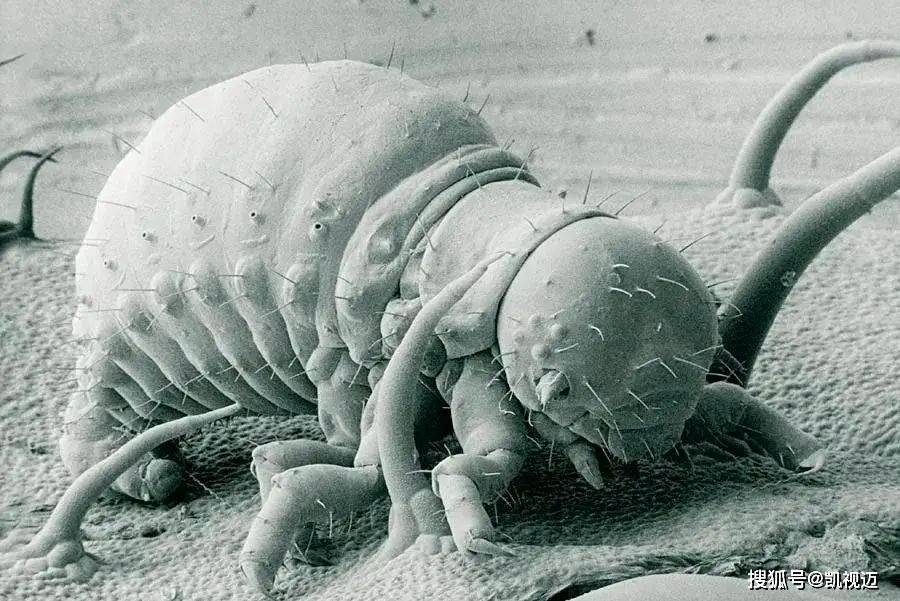 显微镜下的微生物世界：微观中的大宇宙