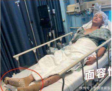 演员陈学冬两年内做4次手术，11部作品被下架，如今生活无法自理