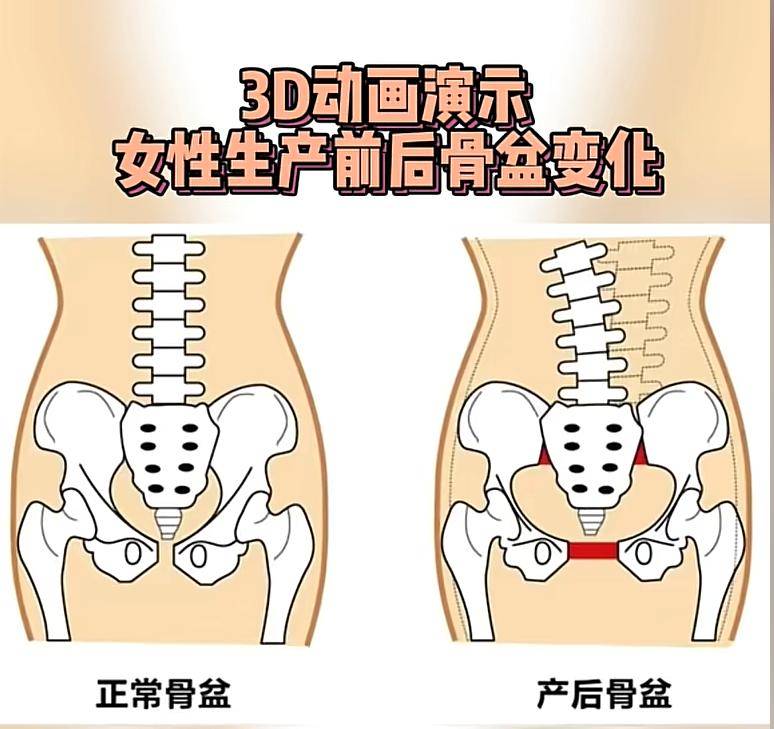 谢娜,钟丽缇生完孩子从少女臀变妈妈臀!网红痞幼自曝手术去除妈妈臀,有六
