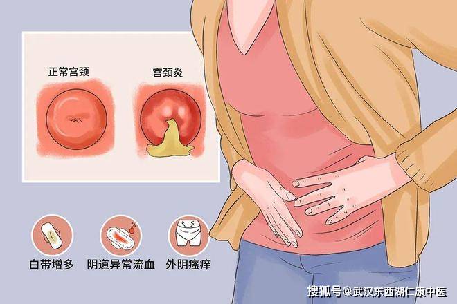 慢性盆腔炎的5大症状，一个都不能忽视