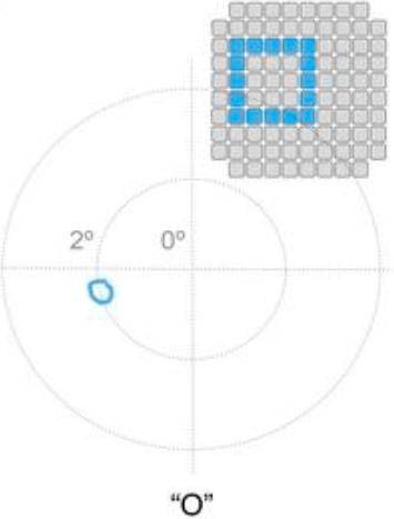 一个意外，脑机接口试验让盲人恢复了视力