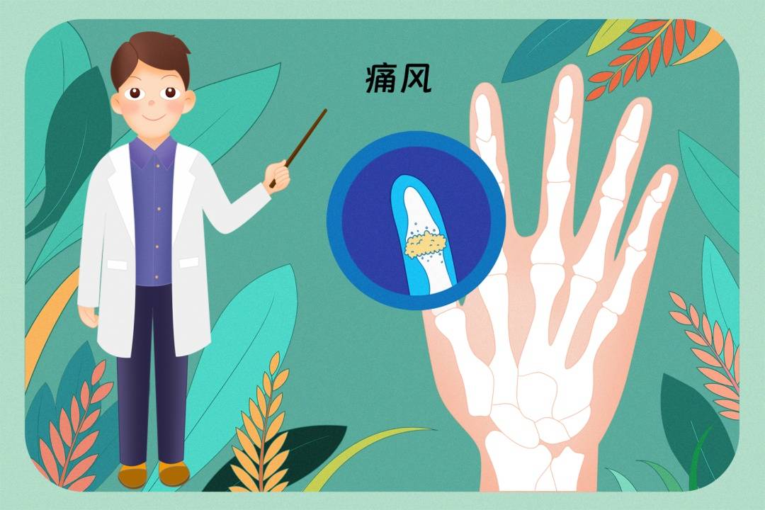 痛风可导致“看不见”的伤害