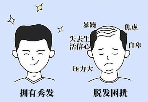 发际线高的人,有多痛苦?