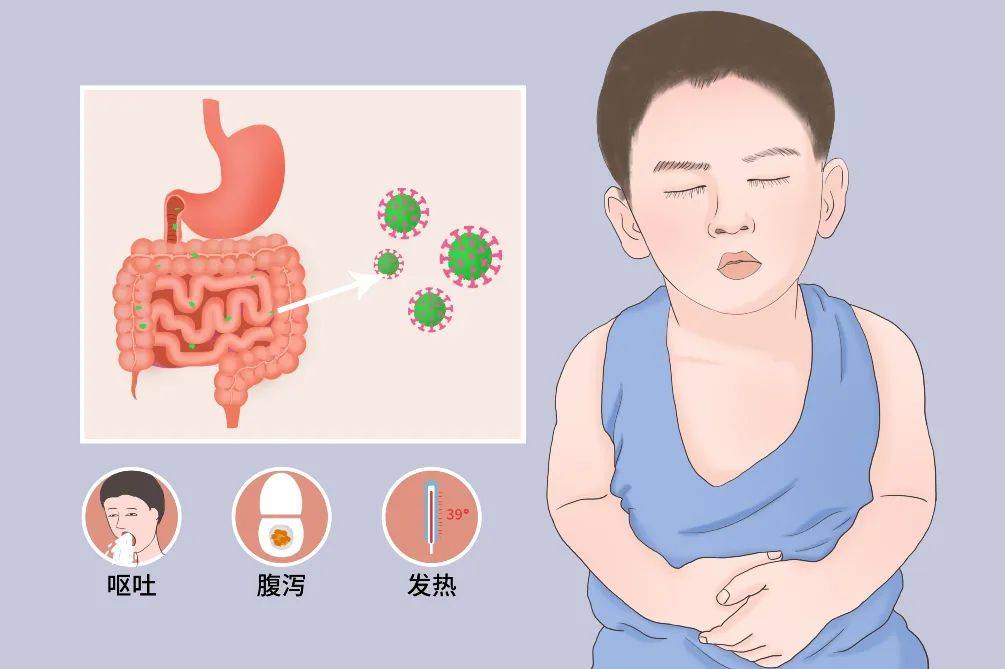 急性肠胃炎会发烧吗图片