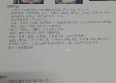 他指的是胎兒頭部從左到右最寬的一段距離,之所以要監測胎兒的雙頂徑