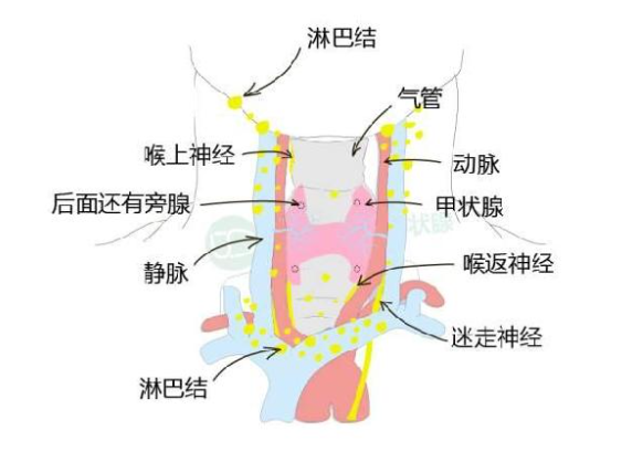 淋巴轉移是指腫瘤細胞沿著淋巴管進入淋巴結,造成頸部或縱隔的淋巴結