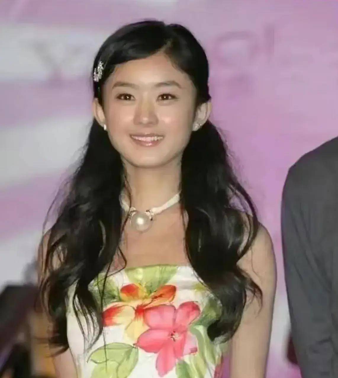 赵丽颖嘴歪,脸僵笑容不自然,出镜有硅胶充气感,被疑医美后遗症_小赵