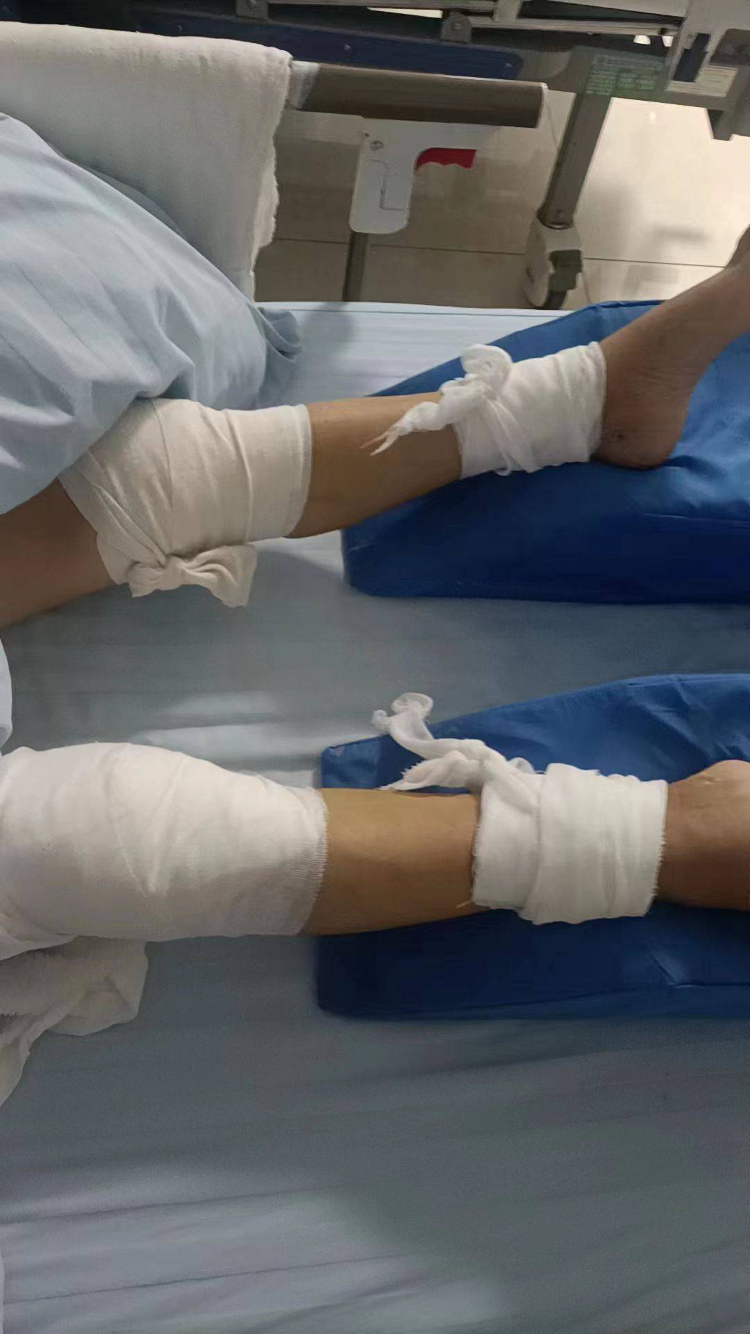 严重车祸致王友荣全身多处骨折,头部出血昏迷23小时,需长期康复治疗!