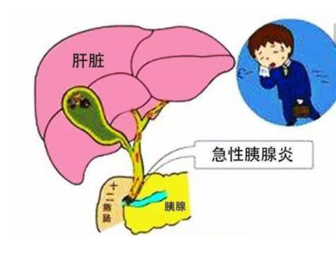 如慢性胰腺炎或胰腺囊肿相关。这些疾病可能影响cea水平，尤其是当它们对胰腺功能产生影响时。