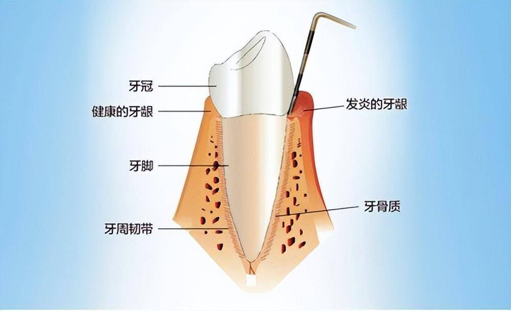 牙齿与牙床结构图图片