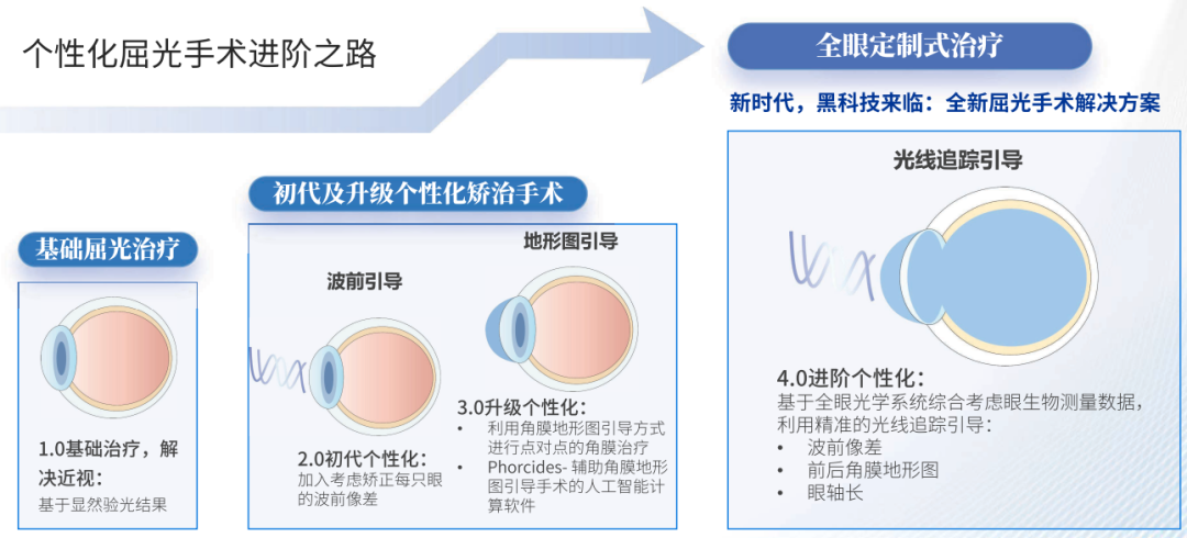 0版本的波前引導來應對眼球波前相差.