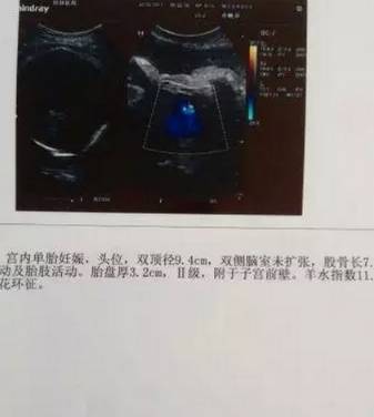 怀孕7周男孩b超图图片图片