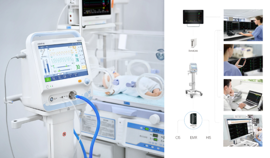 nb350新生兒無創呼吸機通過對附件技術的升級,配備全面的無創呼吸