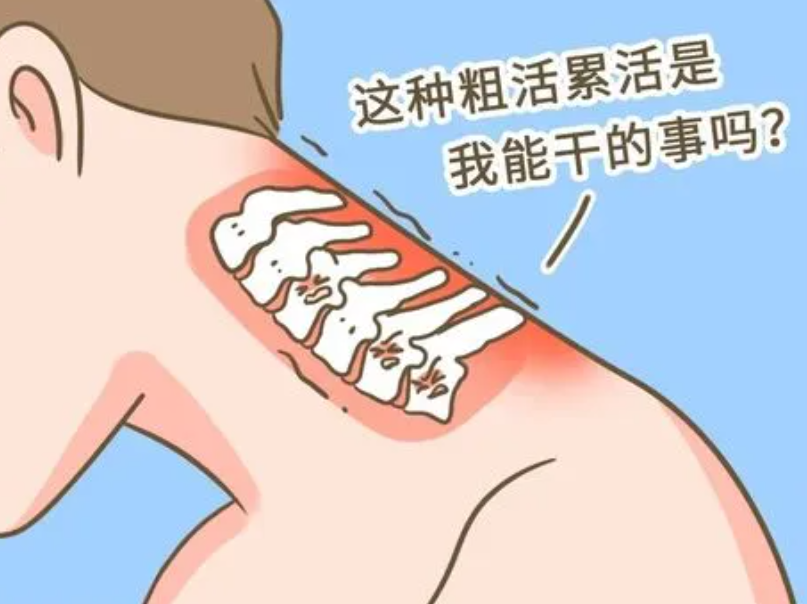 落枕了脖子难受的要命,怎么能最快恢复?_运动_建议_姿势
