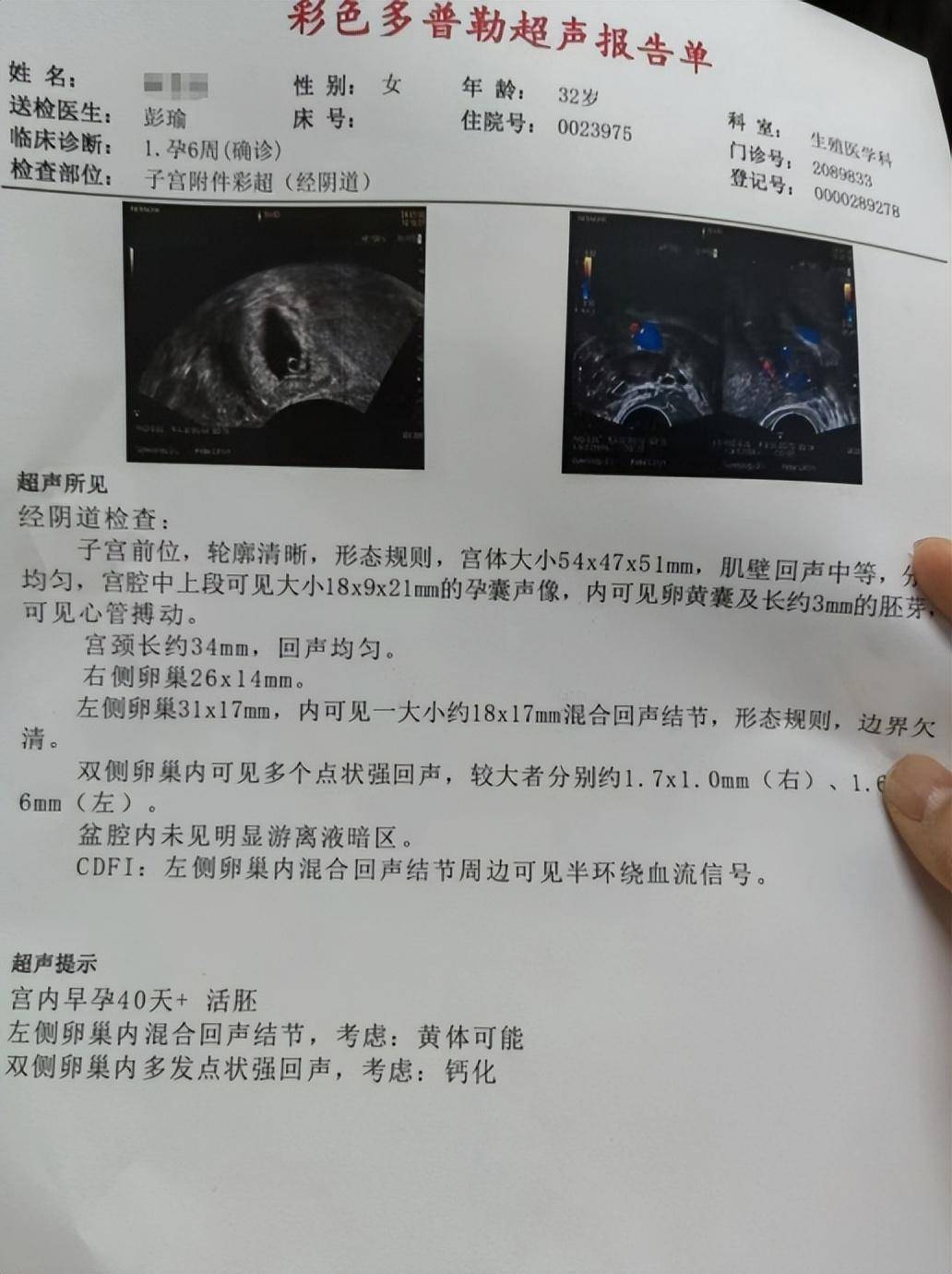 怀孕超声诊断报告单图片