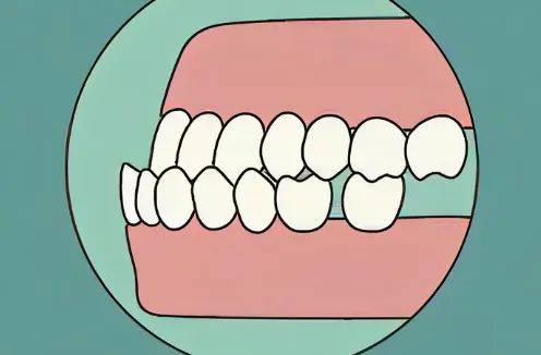 上颌尖牙舌面图片