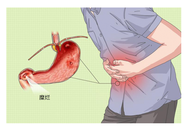 胃出血 卡通图片