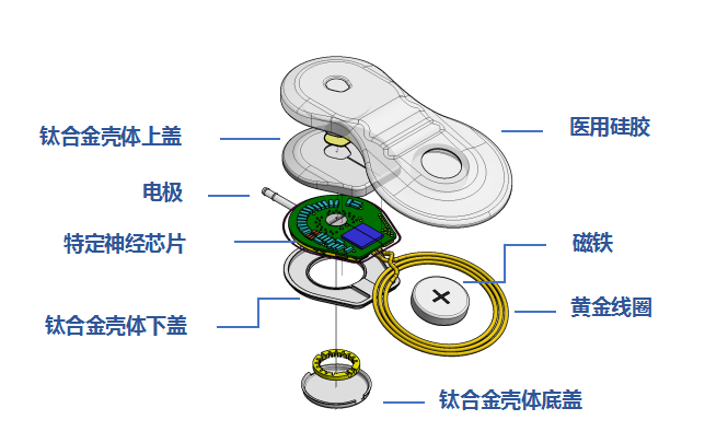 耳蜗简图图片