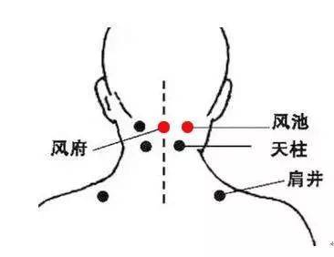 巧用艾灸調理肺心病_正中_中府_病程