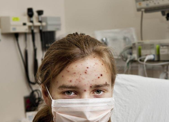 感染"梅毒"后,可能会露出3个"破绽",多留心,早发现早