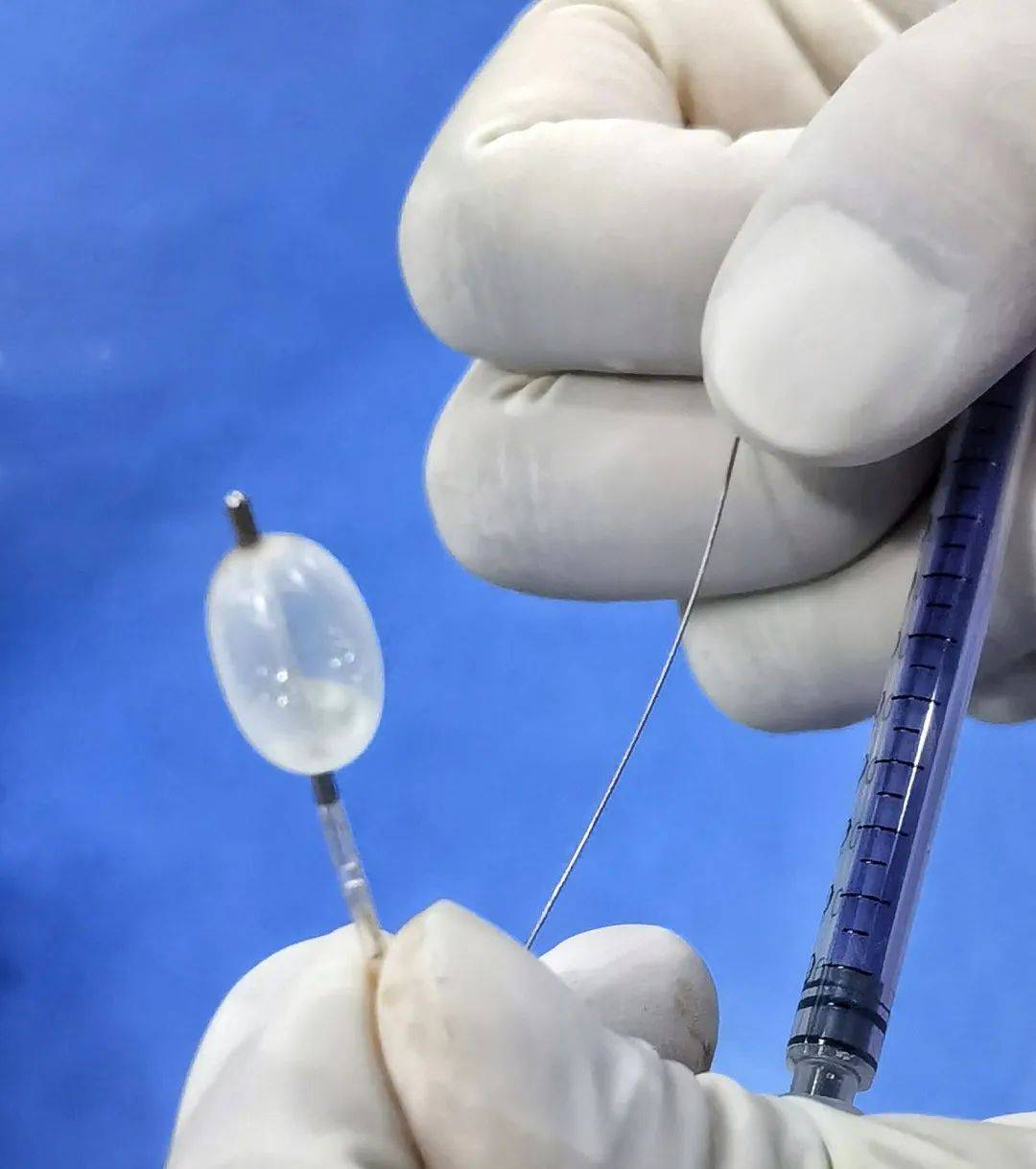 微创球囊解"天下第一痛",让痛不欲生断了"根"_压迫_患者_手术