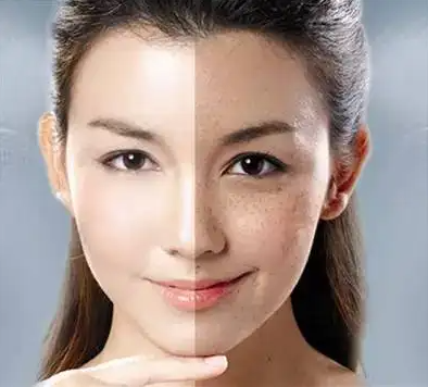 祛斑效果最好的排名第一,实际使用感受分享_肌肤_斑点_套装