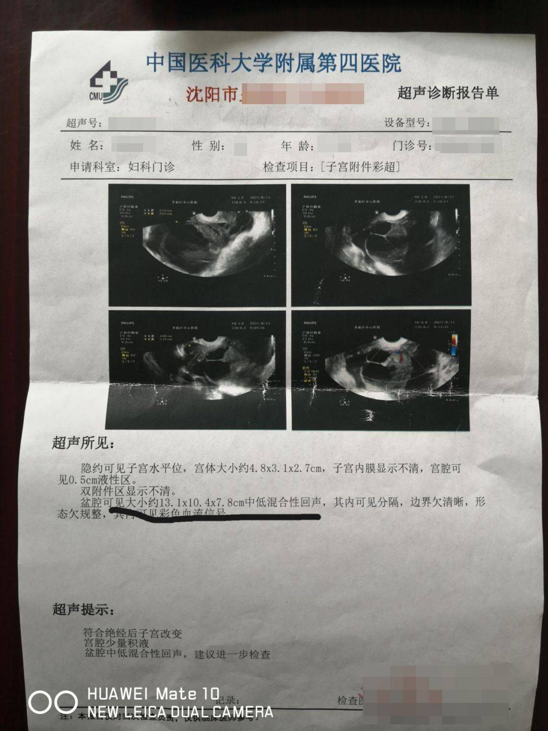 卵巢癌彩超报告单图片图片