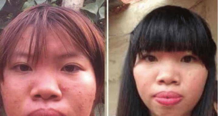 女子花巨资整容嫁富二代,5个月后生娃现原形被甩,现今现状如何_郭金凤