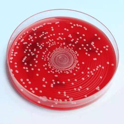 常见的微生物接种方法优缺点_菌落_平板_培养基