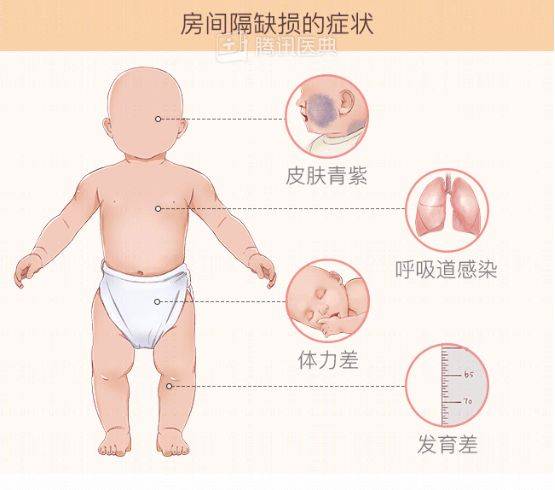 龙陵8名先天性心脏病患儿成功"补心"_陈教授_手术_儿童