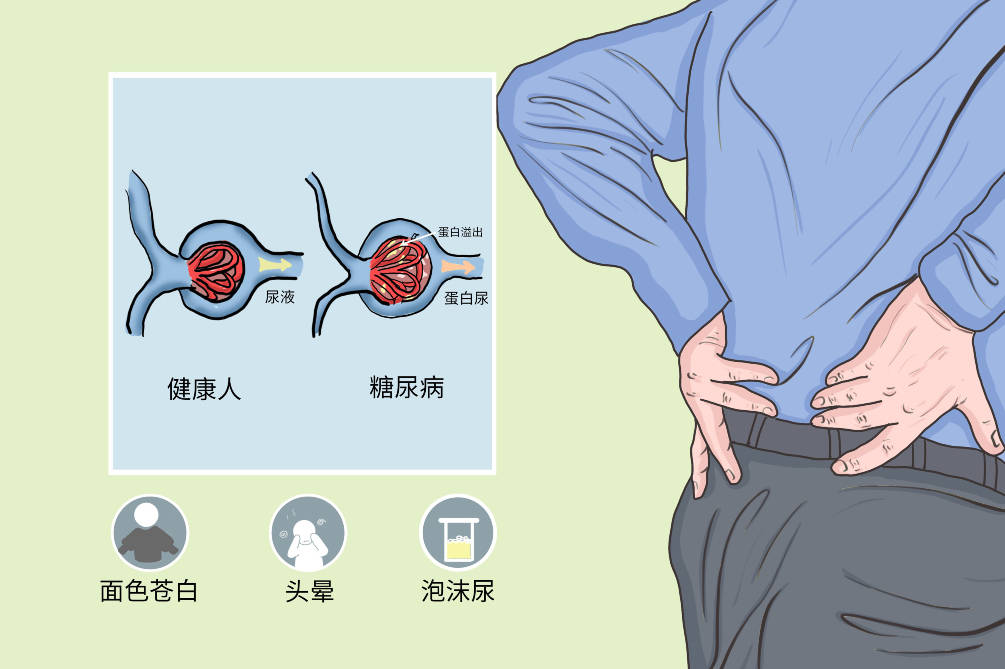糖尿病肾衰怎么控制血糖?_患者_代谢_管理
