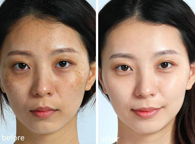 淡斑效果好的护肤品,美白淡斑不反弹