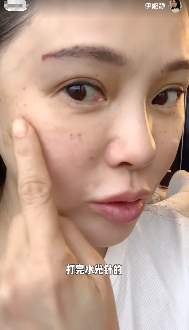 56岁伊能静跑韩国打水光针,晒医美效果像30多,网友:下次带秦昊_哈利