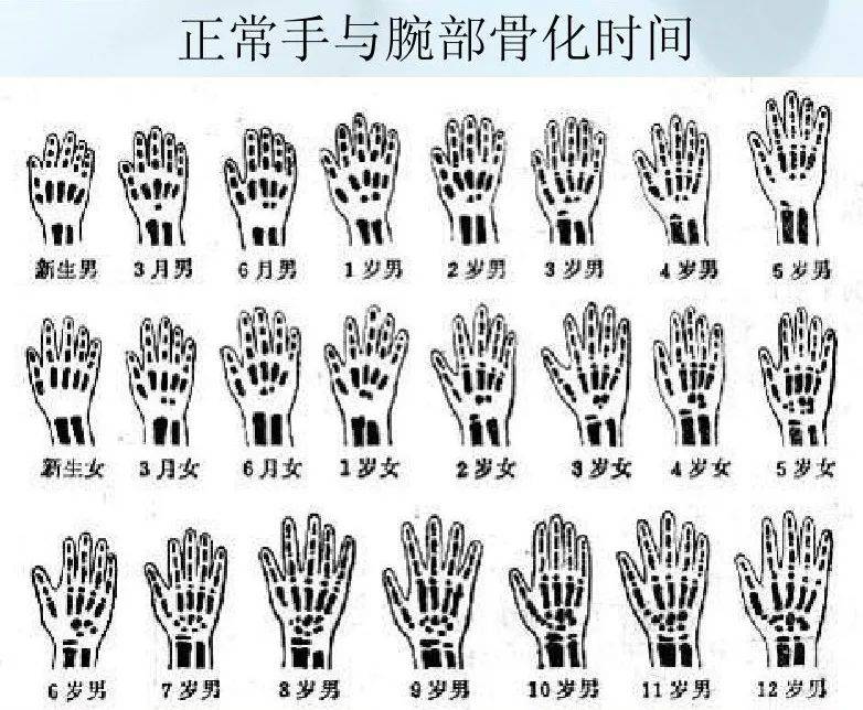 家长_骨骼_遗传