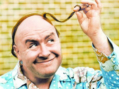 黑米3d纹发:平时掉头发都能长回来,秃顶了怎么就长不回来!