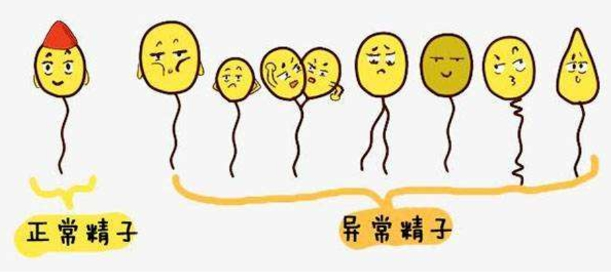 且连续3次以上精液质量分析均提示精子活力低于参考值下限