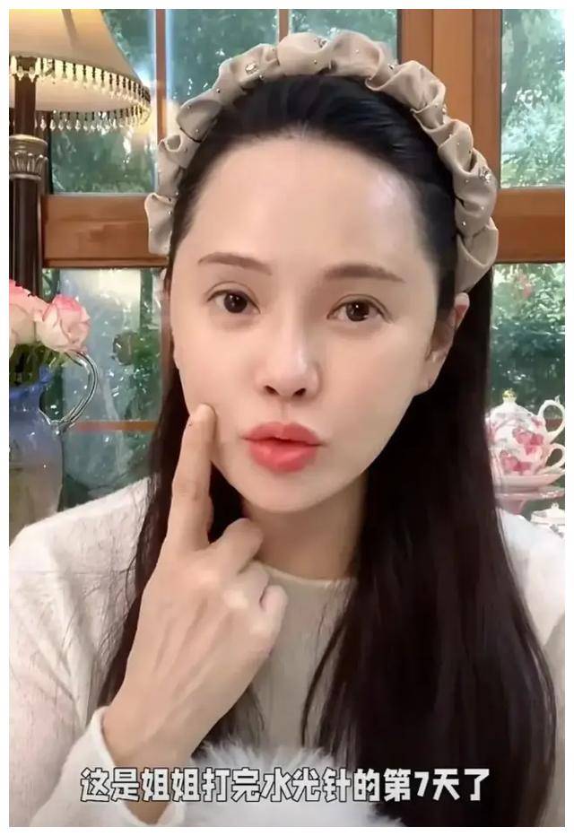 伊能静韩国水光针体验:56岁大胆尝试,痛并快乐!_治疗_生活_秦昊和