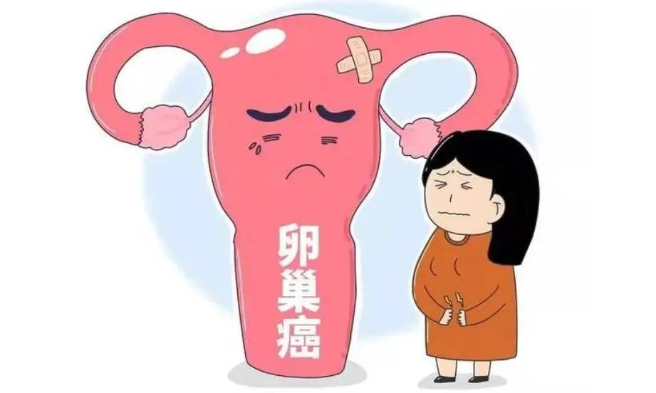 什么人容易得卵巢癌图片