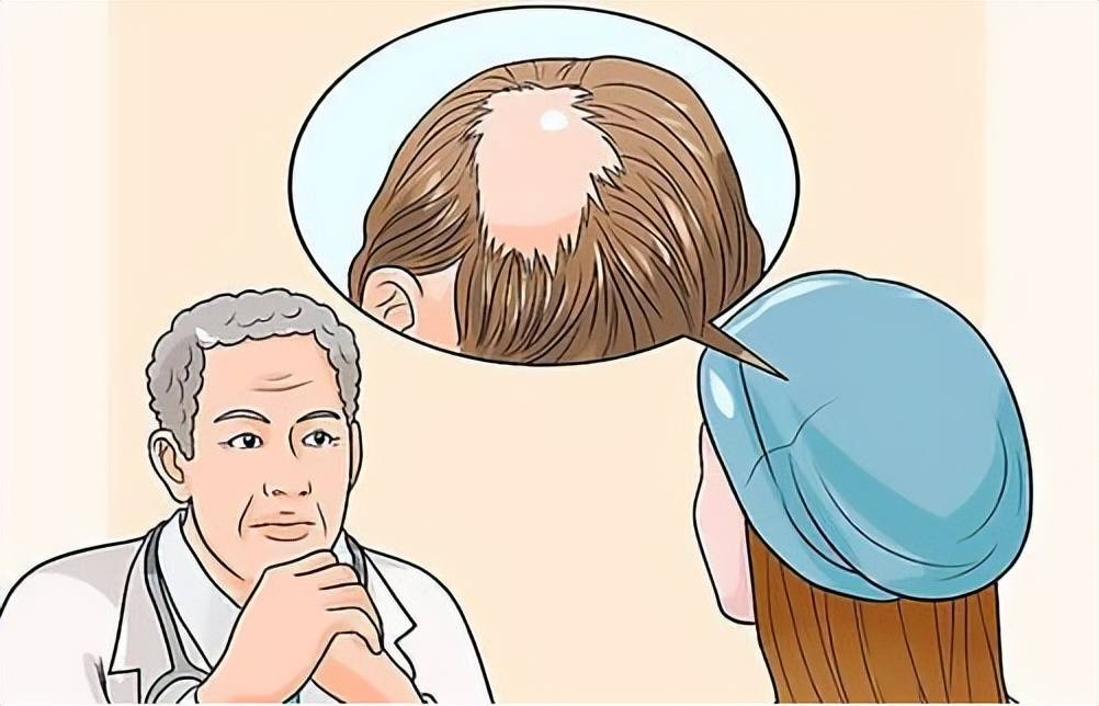 脂溢性脱发怎么防脱?13大护发技巧不容错过_头发_头皮_品牌