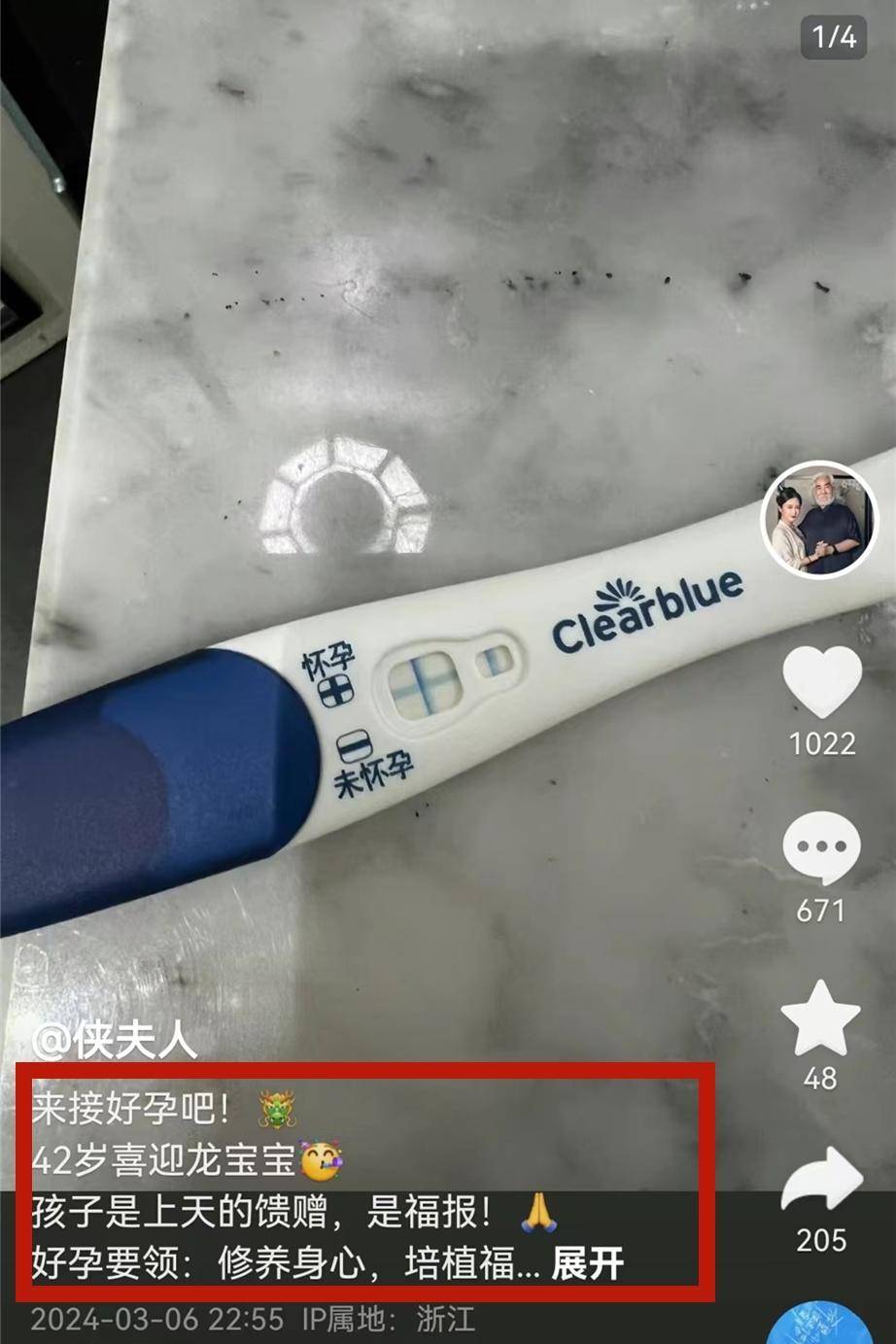 杜星霖怀孕的样子图片