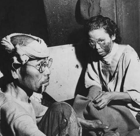 原创为何说核辐射幸存者不能马上洗头说出来可能没人信