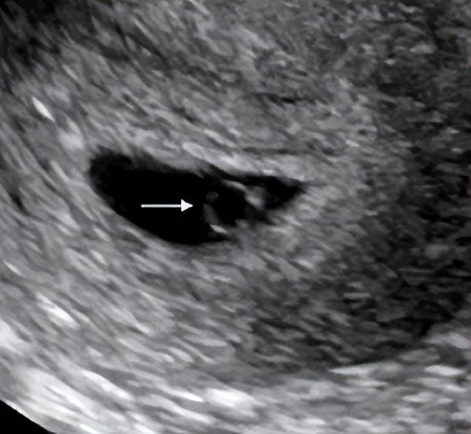 怀孕135天胎儿图片图片