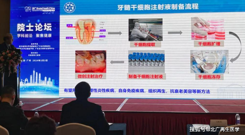 牙髓干细胞：再生牙根的新力量