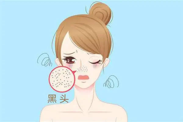 如何彻底去黑头真正好用的去黑头产品推荐去黑头不会大毛孔